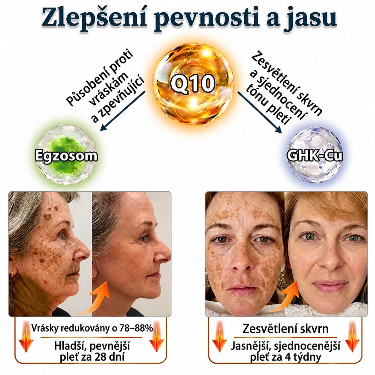 🔥 NORUION® Q10 x Rostlinné nano exosomy – Pokročilý krém proti vráskám