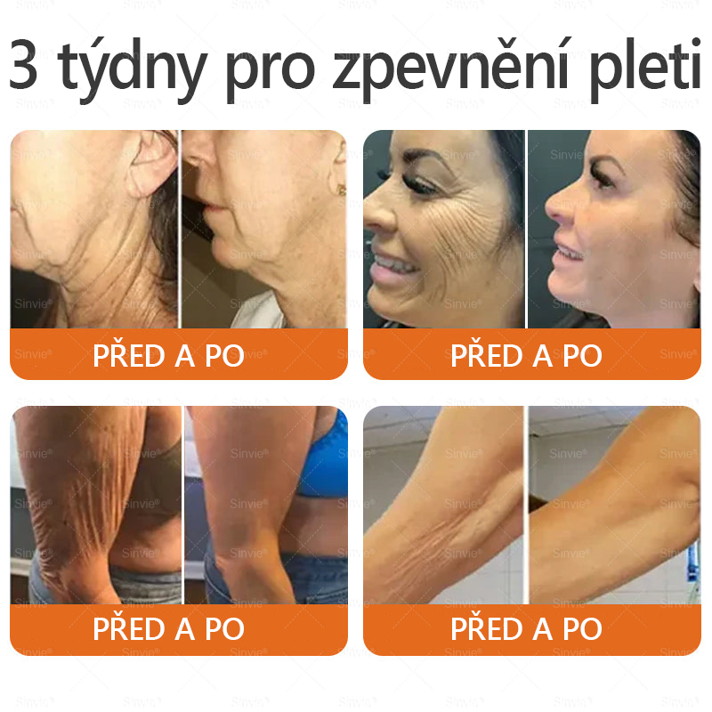 🎁 Doporučení dermatologa 🐝 ✨Sinvie® Krém na obnovu pleti s včelím jedem 🔥 Český vývoj, výroba a dodávka v České republice🎁