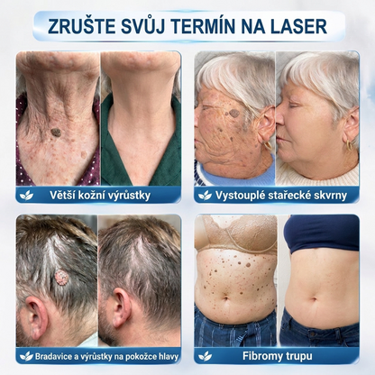 PuraCure® 👩‍⚕️ 𝟕denní Pero na Odstranění Kožních Výrůstků a Skvrn – Bezbolestné Odstranění bez Jizev, Profesionální Roller aplikátor