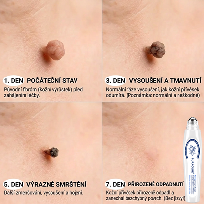 PuraCure® 👩‍⚕️ 𝟕denní Pero na Odstranění Kožních Výrůstků a Skvrn – Bezbolestné Odstranění bez Jizev, Profesionální Roller aplikátor