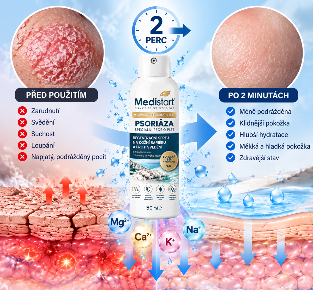 Medistart® PSZORIÁZIS SPECIÁLIS BŐRÁPOLÓ