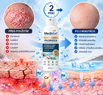 Medistart® PSZORIÁZIS SPECIÁLIS BŐRÁPOLÓ